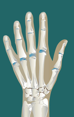 [RA] Tenosynovitis Of The Extensor / Flexor Tendons | SonoTool®